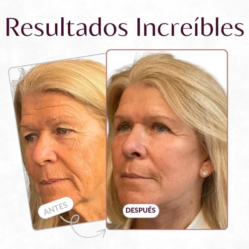 Balsamo de colageno| Hidratación profunda, efecto reafirmante y cuidado antiarrugas para una piel más suave, luminosa y rejuvenecida.