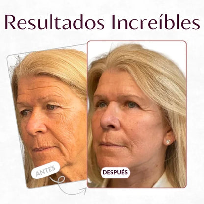 Balsamo de colageno| Hidratación profunda, efecto reafirmante y cuidado antiarrugas para una piel más suave, luminosa y rejuvenecida.